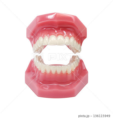 インビザライン マウスピース矯正 イラスト リアル インビザライン マウスピース矯正 イラスト リアル 136115949