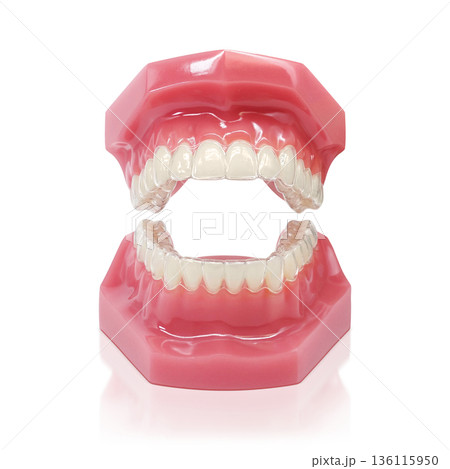 インビザライン マウスピース矯正 イラスト リアル 136115950