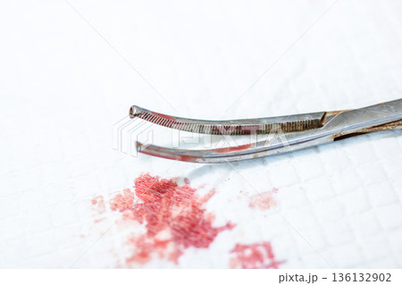 Detailed macro image highlighting risks and precision in emergency medical procedures Detailed macro image highlighting risks and precision in emergency medical procedures 136132902