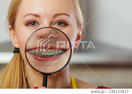 Happy woman showing her braces in magnifying glass Happy woman showing her braces in magnifying glass 136133617