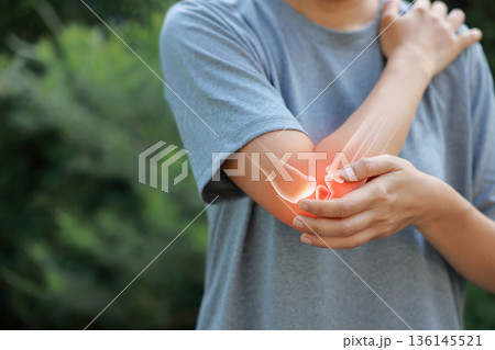 Close-up woman holding painful injured elbow with red inflamed spot and X-ray bone skeleton overlay. Medical concept of joint pain, fracture, arthritis, tendonitis, muscle injury, outdoor background. 136145521