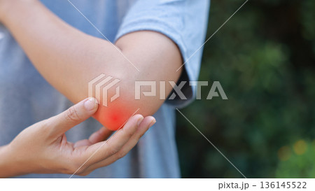 Close-up of woman hand holding painful injured elbow with red inflamed spot. Concept of joint bone pain, muscle injury, arthritis, tendonitis, or ache from sports or work in outdoor background. 136145522
