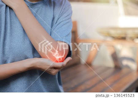 Close-up woman holding painful injured elbow with red inflamed spot and X-ray bone skeleton overlay. Medical concept of joint pain, fracture, arthritis, tendonitis, muscle injury, outdoor background. 136145523