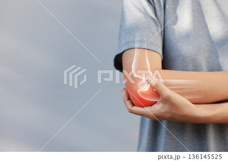 Close-up woman holding painful injured elbow with red inflamed spot and X-ray bone skeleton overlay. Medical concept of joint pain, fracture, arthritis, tendonitis, muscle injury, outdoor background. 136145525