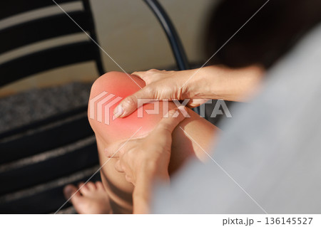 Close-up of woman hand holding painful injured knee with red inflamed spot and bruising. Medical concept of joint pain, arthritis, bone injury, muscle ache, or sprain in outdoor sunlight background. 136145527