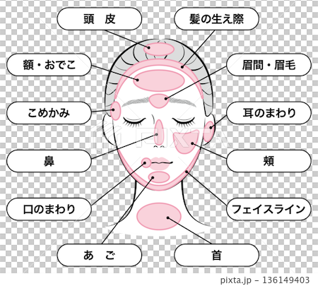 ニキビができやすい場所マップ 136149403