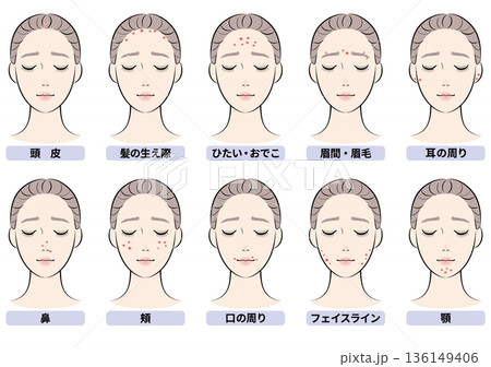 ニキビができやすい顔の部位セット 136149406