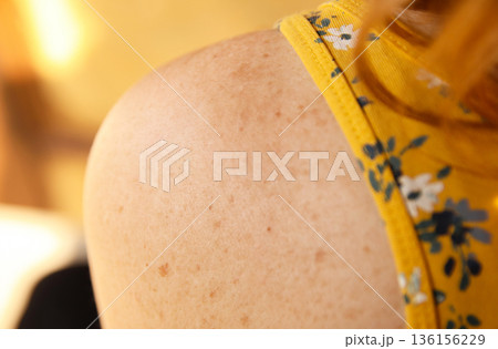 Close-up of woman freckled shoulder in yellow floral top, warm light. Macro freckled shoulder in floral dress, intimate beauty portrait. Natural Beauty, Skin Texture 136156229