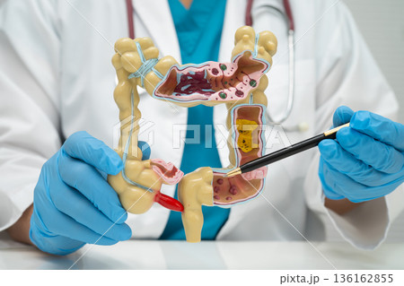 Intestine, doctor holding human model in hospital. Intestine, doctor holding human model in hospital. 136162855