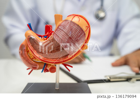 Stomach disease, doctor holding anatomy model. Stomach disease, doctor holding anatomy model. 136179094