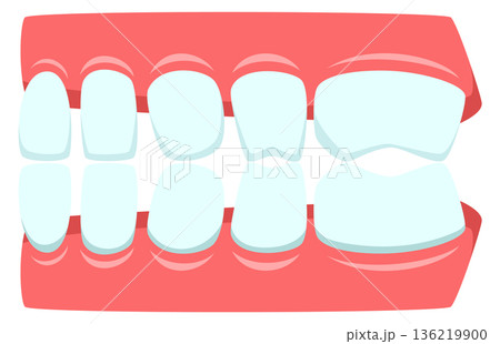 Teeth jaw illustration. Dental anatomy. Oral health Teeth jaw illustration. Dental anatomy. Oral health 136219900