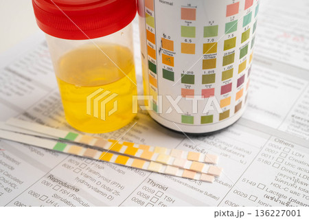 Urinalysis, urine cup with reagent strip pH paper test and comparison chart in laboratory. 136227001