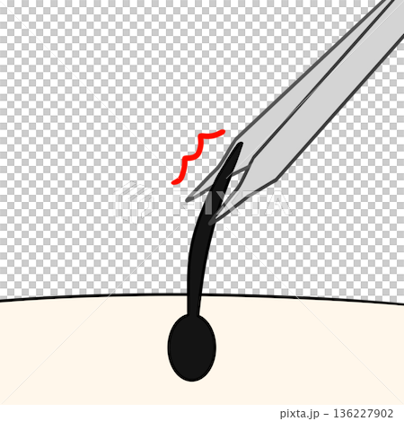 ピンセットで毛を抜く 136227902