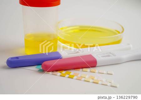 Urinalysis, urine cup with reagent strip pH paper test and comparison chart in laboratory. 136229790