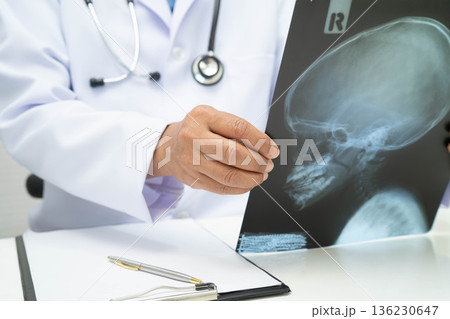 Doctor examining brain radiography xray film. Doctor examining brain radiography xray film. 136230647