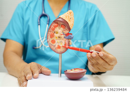 Chronic kidney disease, doctor with model for treatment urinary system, urology, Estimated glomerular filtration rate eGFR. Chronic kidney disease, doctor with model for treatment urinary system, urology, Estimated glomerular filtration rate eGFR. 136239484