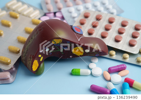 Liver model with pill drug treatment, Cirrhosis, Liver cancer, fatty liver. 136239490