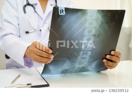 Doctor examining spine bone radiography xray film. 136239512