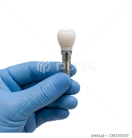Dentist's hand in a blue nitrile glove carefully holding a realistic titanium dental implant, isolated on white. Represents modern tooth replacement surgery 136250107