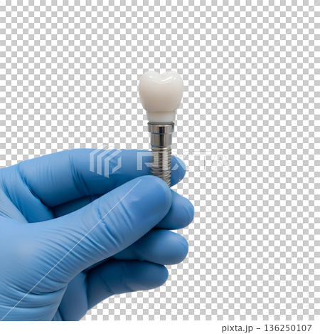 Dentist's hand in a blue nitrile glove carefully holding a realistic titanium dental implant, isolated on white. Represents modern tooth replacement surgery 136250107