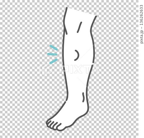 足のむくみ・圧痕性浮腫のイラスト(指で押した跡が戻らない状態) 足のむくみ・圧痕性浮腫のイラスト(指で押した跡が戻らない状態) 136262633
