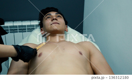 Male patient receiving chest hair removal procedure Male patient receiving chest hair removal procedure 136312180