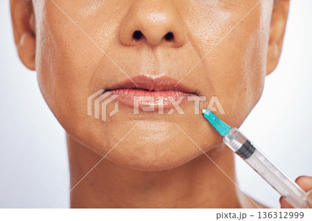 Lips, injection and face of woman for plastic surgery in studio, white background and skincare. Closeup of female model, cosmetics and syringe on mouth for dermatology, facelift and filler for beauty 136312999