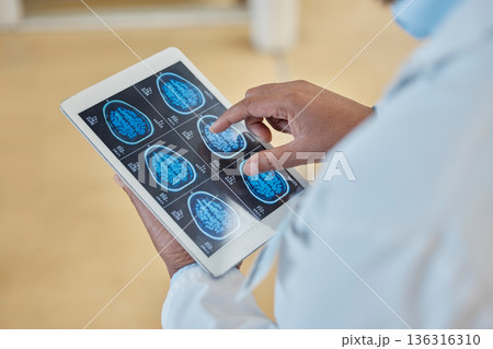 Brain scan, xray and closeup of a doctor with a tablet for a neurology consultation or surgery. Healthcare, digital technology and hands of surgeon analyzing a mri image in medical hospital or clinic 136316310