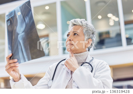 Woman, radiology doctor and thinking with xray of test results, chart or healthcare analysis idea. Serious female surgeon planning ideas, medical solution and x ray report of bones, anatomy or injury Woman, radiology doctor and thinking with xray of test results, chart or healthcare analysis idea. Serious female surgeon planning ideas, medical solution and x ray report of bones, anatomy or injury 136319428