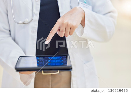 Doctor, hands and tablet for neurology research in hospital, healthcare and telehealth for xray. Technology, medical professional and person with brain mri on app for wellness, radiology and results. Doctor, hands and tablet for neurology research in hospital, healthcare and telehealth for xray. Technology, medical professional and person with brain mri on app for wellness, radiology and results. 136319456