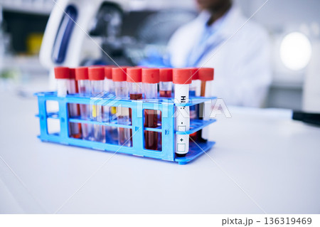 Medical, research and vials with blood test, science and breakthrough with discovery, experiment and project. Tube, healthcare and laboratory equipment with scientific innovation and chemical liquid Medical, research and vials with blood test, science and breakthrough with discovery, experiment and project. Tube, healthcare and laboratory equipment with scientific innovation and chemical liquid 136319469