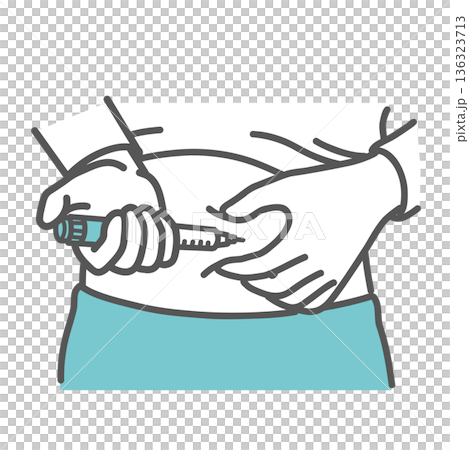 Illustration of self-injection of insulin (injection into the abdomen, pinching the skin) 136323713