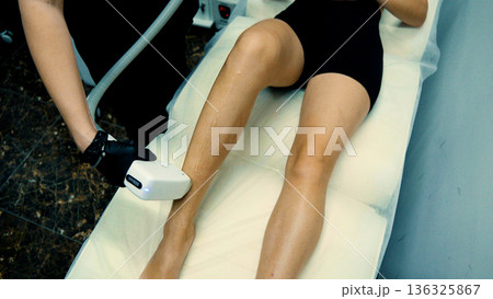 Detailed view of laser hair removal on female skin 136325867
