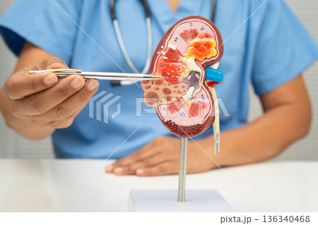 Chronic kidney disease, doctor with model for treatment urinary system, urology, Estimated glomerular filtration rate eGFR. Chronic kidney disease, doctor with model for treatment urinary system, urology, Estimated glomerular filtration rate eGFR. 136340468