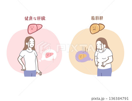 健康な肝臓と脂肪肝の女性のイラストセット 136384791