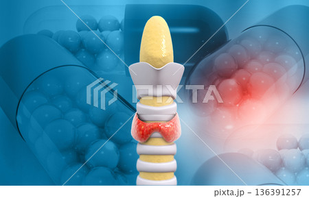 thyroid gland with medicine, hyperthyroidism 136391257