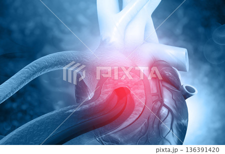 Human heart angioplasty 136391420