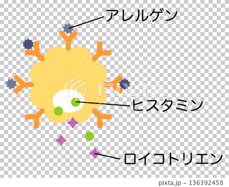 肥満細胞 アレルゲンとlgE抗体が結合して、ヒスタミンやロイコトリエンが排出される 肥満細胞 アレルゲンとlgE抗体が結合して、ヒスタミンやロイコトリエンが排出される 136392458