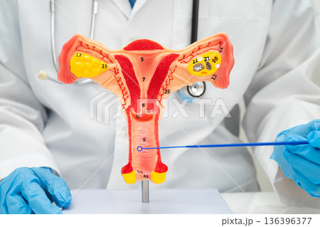 Doctor holding human uterus model for vaginal and cervix pap smear check up in the obstetrics and gynecology. 136396377