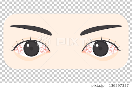 Vector illustration of bloodshot eyes Vector illustration of bloodshot eyes 136397337