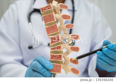 Doctor holding osteoporosis in back bone model for treatment medical. Doctor holding osteoporosis in back bone model for treatment medical. 136398208