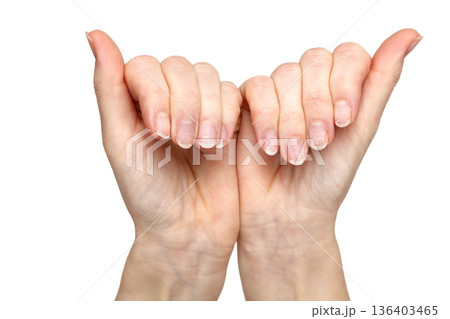 Damaged fingernails after gel polish removal Damaged fingernails after gel polish removal 136403465