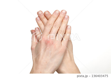 Damaged fingernails after gel polish removal 136403475