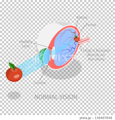 3D Isometric Flat Illustration of Vision Disorder. Item 3 3D Isometric Flat Illustration of Vision Disorder. Item 3 136407648