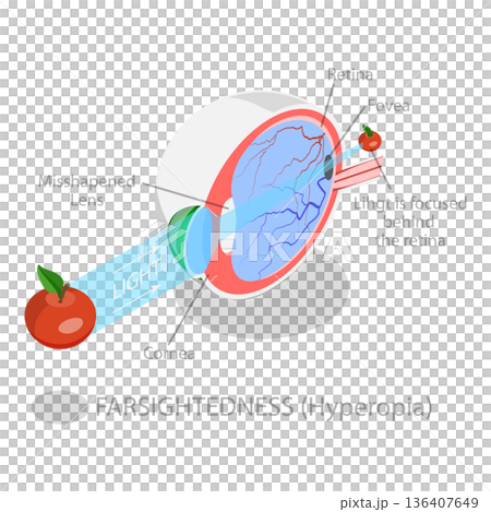 3D Isometric Flat Illustration of Vision Disorder. Item 2 3D Isometric Flat Illustration of Vision Disorder. Item 2 136407649