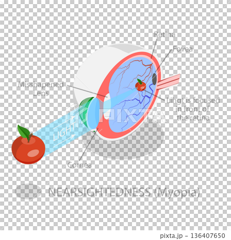 3D Isometric Flat Illustration of Vision Disorder. Item 1 3D Isometric Flat Illustration of Vision Disorder. Item 1 136407650