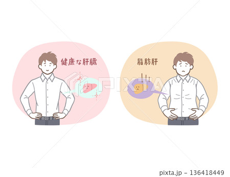 健康な肝臓と脂肪肝の男性のイラストセット 136418449