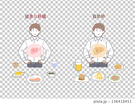 健康な肝臓と脂肪肝の男性のイラストセット 136418451