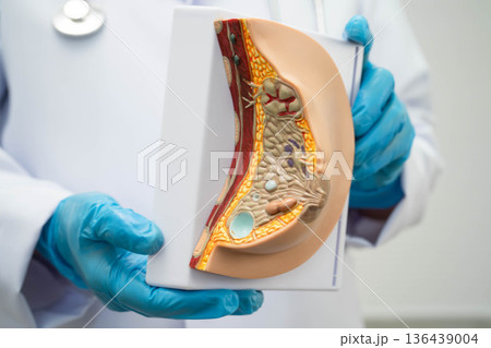 Doctor holding female breast human anatomy model. Doctor holding female breast human anatomy model. 136439004