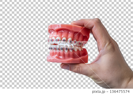 Hand holding dental teeth model with metal braces, perfect for orthodontic education, dentist offices, and smile makeover concepts Hand holding dental teeth model with metal braces, perfect for orthodontic education, dentist offices, and smile makeover concepts 136475574